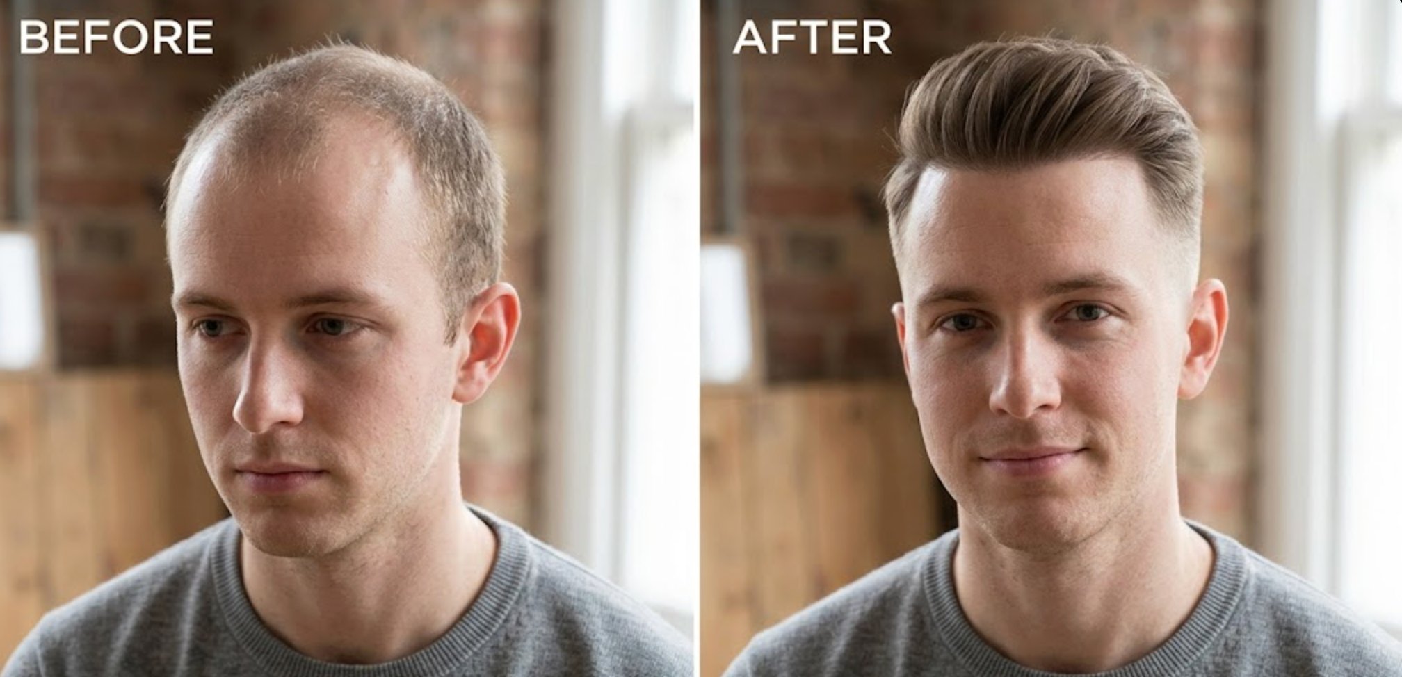 Before and after