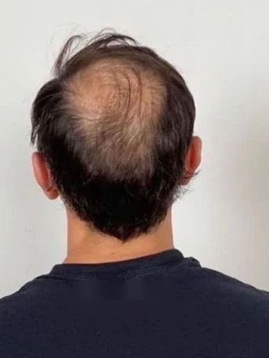 Before, from behind