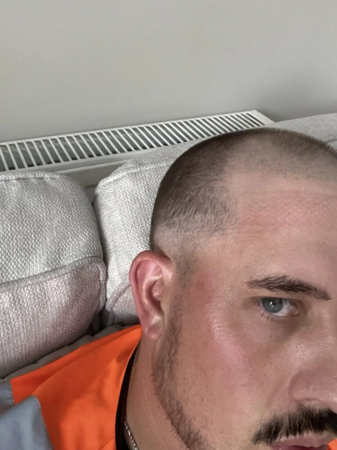 Before, buzzed with a visible hairline