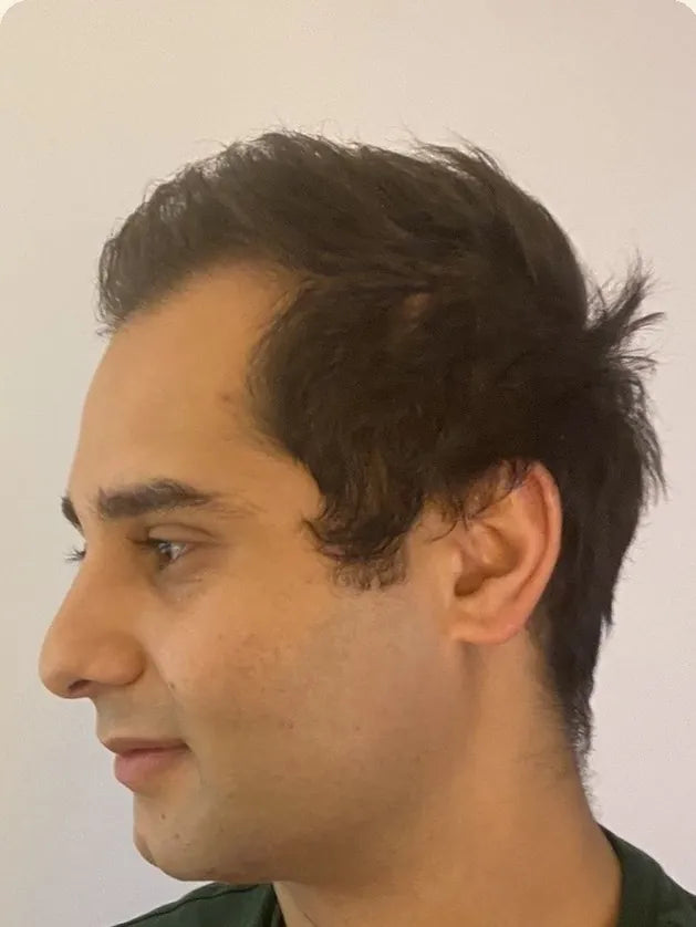 James in profile, before