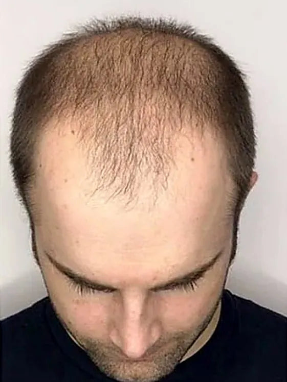 Before, top down